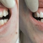 Реставрация зубов. Красивую и здоровую улыбку вам подарит стоматологическая клиника «Стома Сервис».